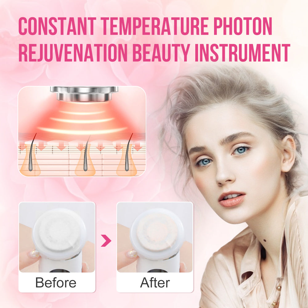 IPL Face-lifting Skin Rejuvenation Device - Lady Personalize Me LLC