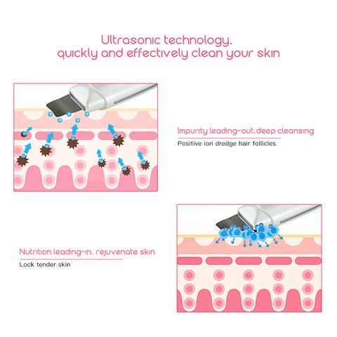 Ultrasonic Skin Scrubber - Lady Personalize Me LLC